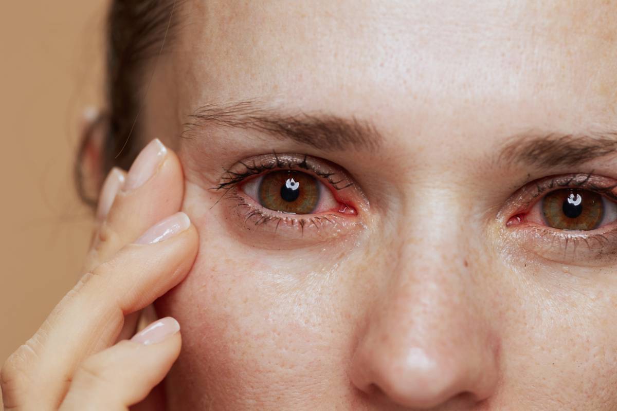 Featured image for Can Dry Eye Syndrome Cause Blindness