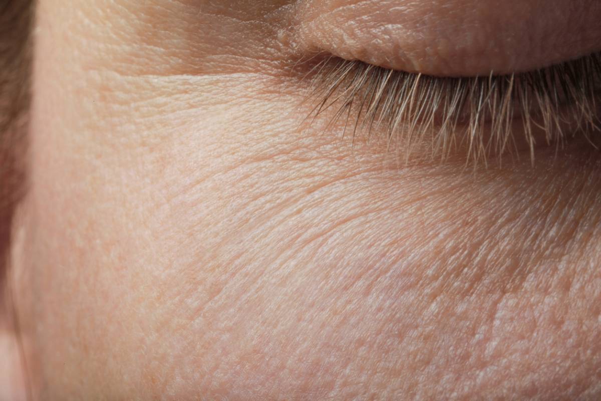 Secondary image for Why Do We Develop Wrinkles?